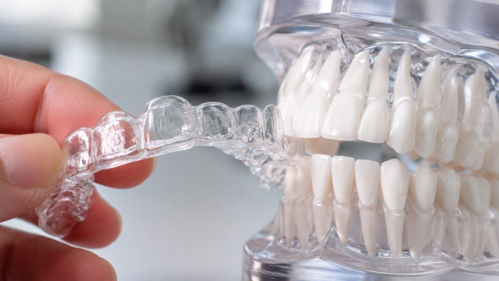 Will Your Teeth Shift Without a Retainer?