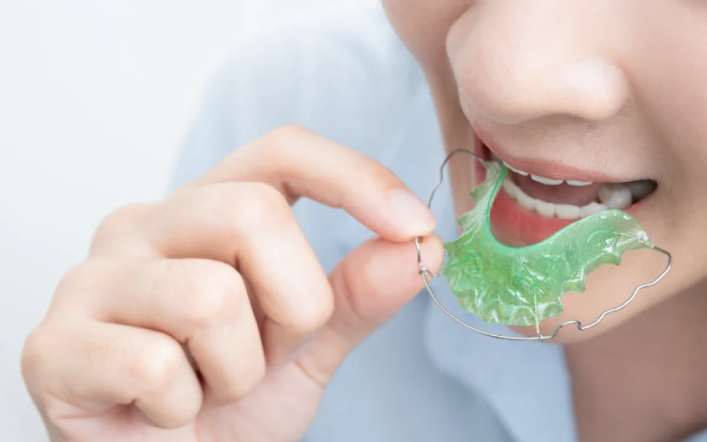 What Is a Removable Retainer?