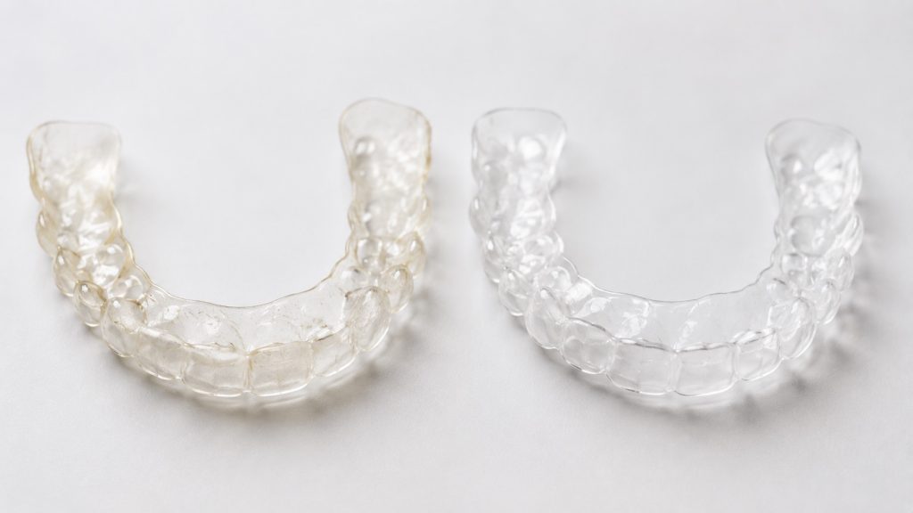 What Can You Use as a Temporary Retainer?