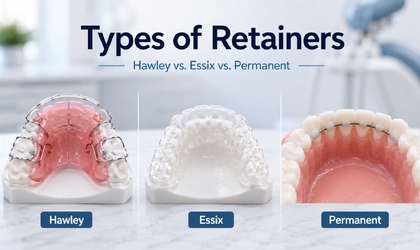 Types of Retainers - Hawley vs. Essix vs. Permanent-photo
