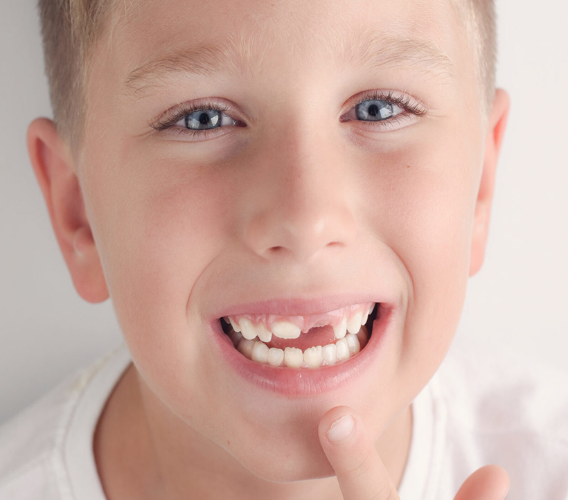 Early Orthodontics & Dentofacial Orthopedics